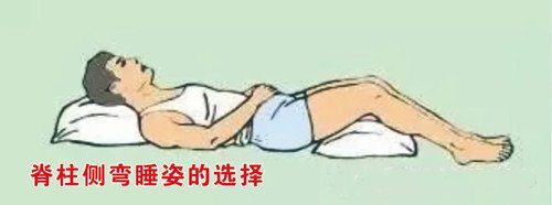 睡姿不正確會(huì)對脊柱側(cè)彎產(chǎn)生影響嗎？